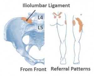 Liiolumbar Ligament